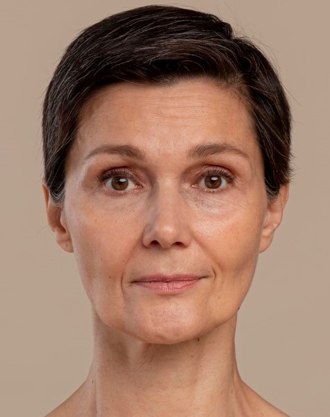 Antes del tratamiento